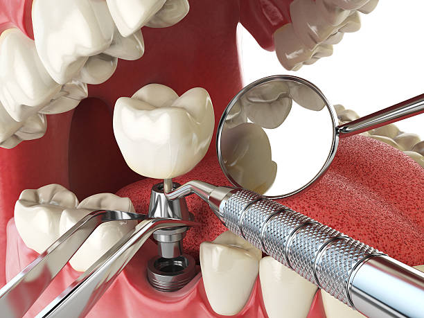 Best Emergency Care for Gum Disease in De Pue, IL